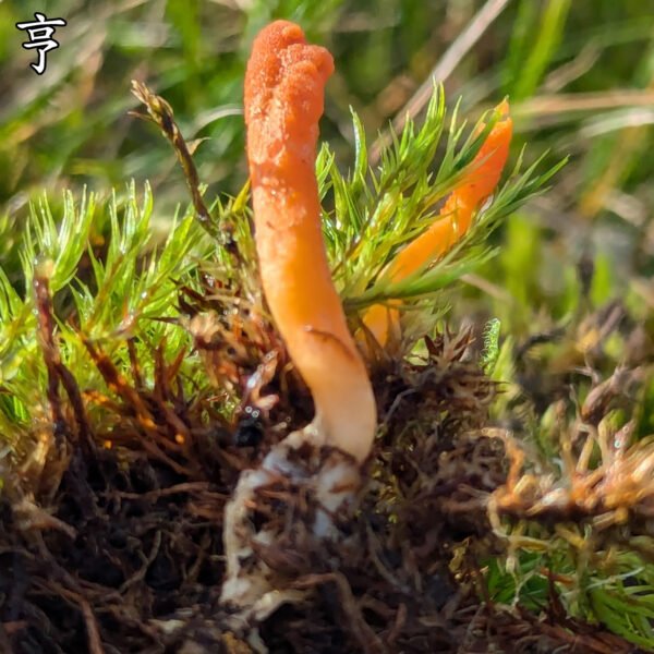 亨廷顿舞蹈症